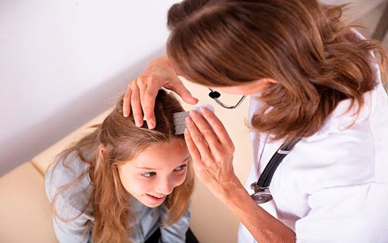 traitement du psoriasis crânien chez les enfants